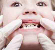 Зошто децата се претвори црно бебе заби?