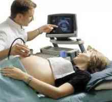 Индикатори ултразвук 32 недели на бременост