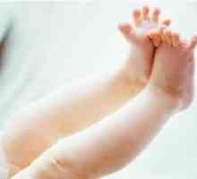 Испотени нозе бебе