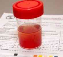 Зголемување на црвени крвни клетки во урината