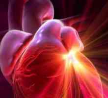 Стекнати срцеви заболувања валвуларна