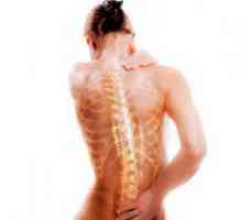 Знаци на остеопороза