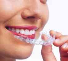 Транспарентен mouthguard на усогласување на забите