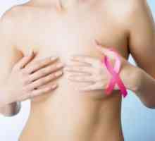 Рак на дојка - Симптоми