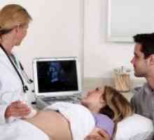 Расчекор помеѓу пубисот симфизата во бременоста