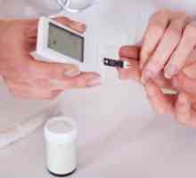 Дијабетес мелитус тип 2 - Симптомите