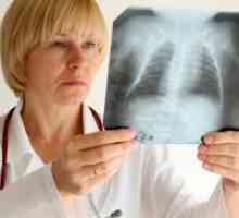 Саркоидоза на белите дробови - симптомите
