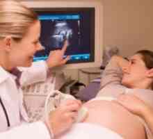 Чукање на срцето на фетусот во 12 недели