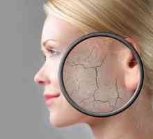 Силно лушпеста кожа на лицето: Причини и третман