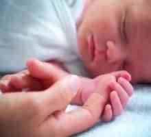 Респираторен дистрес синдром кај новороденчињата