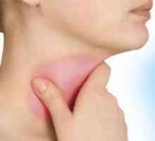 Стрептокок грлото