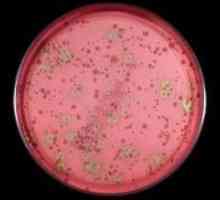 Streptococcus viridans