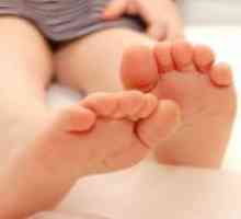 Нозете на бебето повреден во текот на ноќта