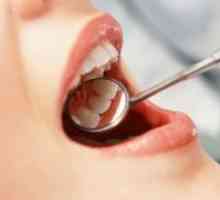 Вадење на заб нерв