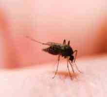 Каснување од комарец - Како да се отстрани оток?