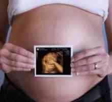 Ултразвук на фетусот 12 недели