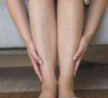 Вени на нозете - третман