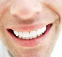 Видови на забни протези