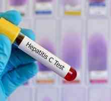 На вирусна товар во хепатитис со