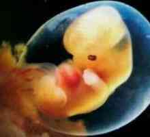 Претворање во стакло на ембриони