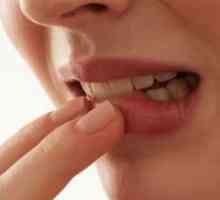 Воспаление на гингивата околу забот