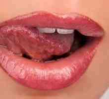 Воспаление на јазикот