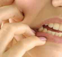 Воспаление на надкостница на забот