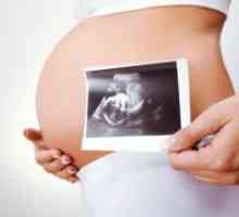 Штетен ако ултразвук за време на бременоста?