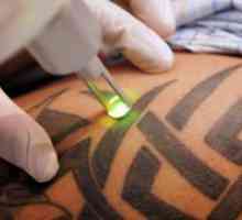 Повлекување тетоважи