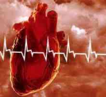 Болести на кардиоваскуларниот систем