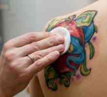 Тетоважа лекување