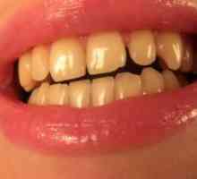 Жолти заби