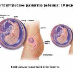 Акушерски 10 недела од бременоста