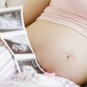 13 Недели од бременоста - феталната големина