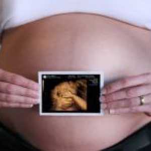 35 Недели од бременоста - што се случува?