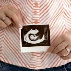 6 Недели од бременоста - феталниот развој