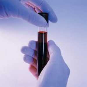 Тест на крвта за бременост