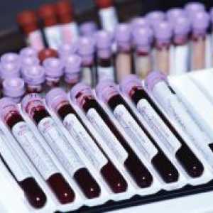 Крв во онкологијата