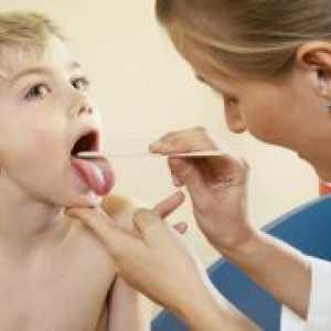 Антибиотици за болки во грлото кај децата