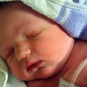 Езофагеална атрезија кај новородени