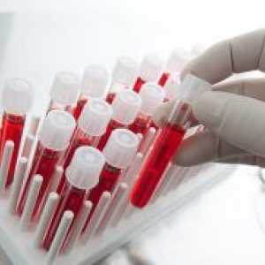 Крв биохемија - препис