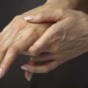 Болно палецот на раката во флексија