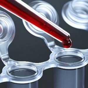 Што прави тест на крвта ЦЕА?