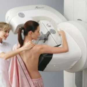 Дигитална мамографија