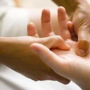 Деформирање артроза на рацете - третман