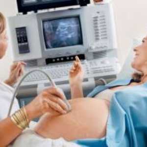Доплер за време на бременоста - што е тоа?