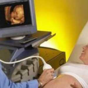 Доплер за време на бременоста - препис