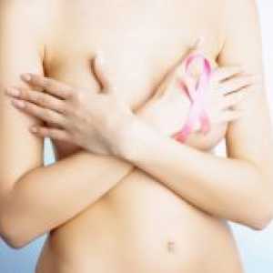 Фиброза на дојка