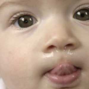 Физиолошки течење на носот кај доенчиња