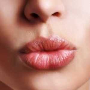 Херпес на усните - брз третман